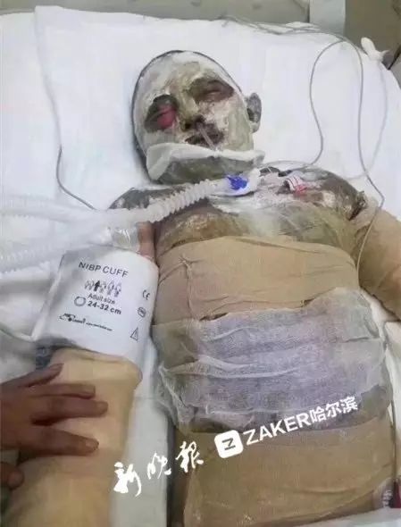 新澳门一码一码100准确_网红为燃气爆炸烧伤妈妈捐款30万,实地数据评估解析_RemixOS79.17.38