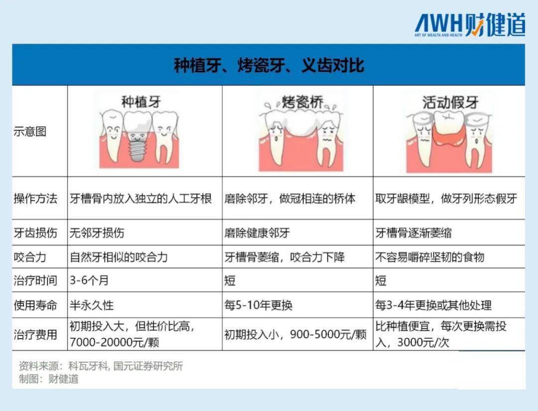 牙齿集采最新资讯，笑料满满的牙科之旅揭秘
